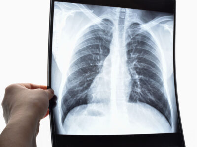 Curso de Fundamentos Anatómicos y Fisiológicos del Aparato Circulatorio y Respiratorio para TSID